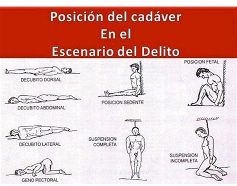posiciones cadavericas